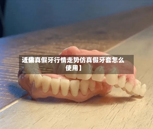 近来
【仿真假牙行情走势仿真假牙套怎么使用】-第2张图片